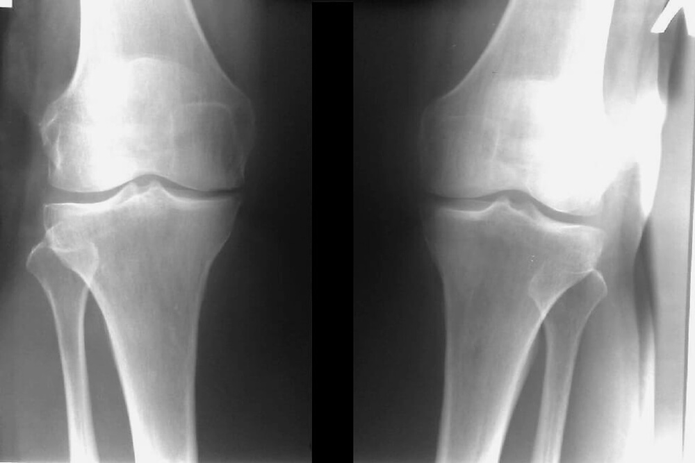 рентген костей и суставов.jpg